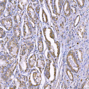 Anti-TOM1L1 Antibody