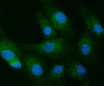 Anti-TOLLIP Antibody