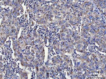 Anti-TOLLIP Antibody