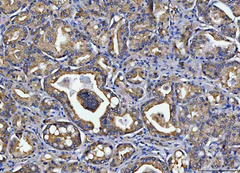 Anti-TOLLIP Antibody