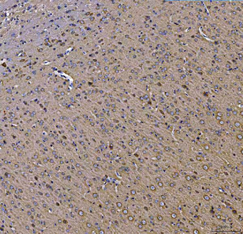 Anti-TOLLIP Antibody
