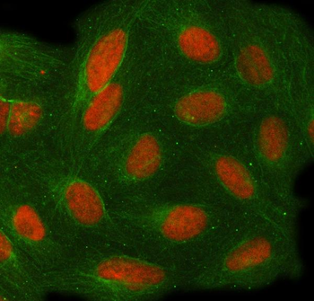 Anti-TOE1 Antibody