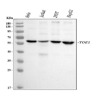 Anti-TOE1 Antibody
