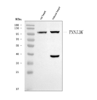 Anti-TNNI3K Antibody