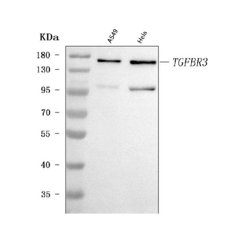 Anti-TGF beta Receptor III/TGFBR3 Antibody