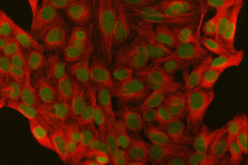 Anti-SFPQ Antibody