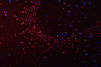 Anti-SFPQ Antibody