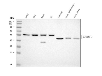 Anti-SERBP1 Antibody