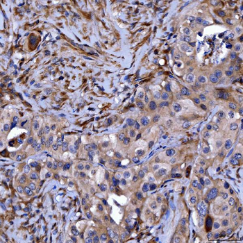 Anti-Septin 11/SEPTIN11 Antibody