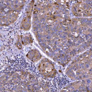 Anti-Septin 11/SEPTIN11 Antibody
