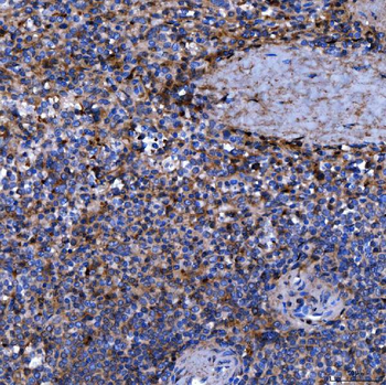 Anti-Septin 11/SEPTIN11 Antibody