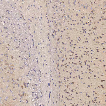 Anti-Septin 11/SEPTIN11 Antibody