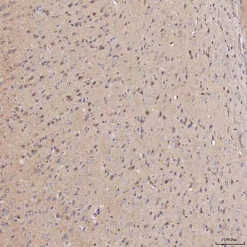 Anti-Septin 11/SEPTIN11 Antibody