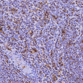 Anti-SEPT6/SEPTIN6 Antibody