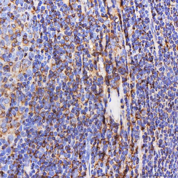 Anti-SEPT6/SEPTIN6 Antibody