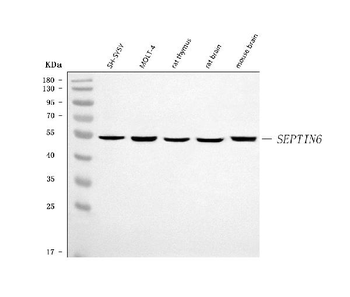 Anti-SEPT6/SEPTIN6 Antibody