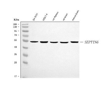 SEPT6/SEPTIN6 Antibody
