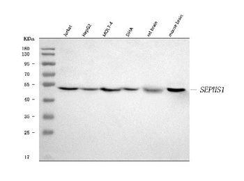Selenophosphate synthetase 1/SEPHS1 Antibody