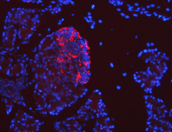 Anti-SEL1L Antibody