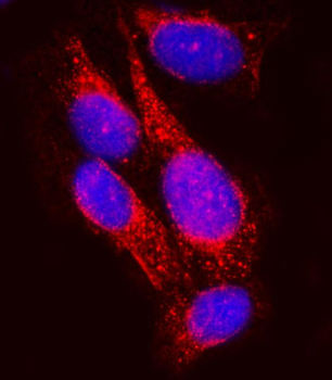 Anti-SEL1L Antibody