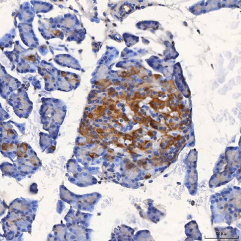 Anti-SEL1L Antibody