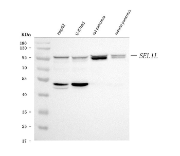 Anti-SEL1L Antibody