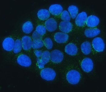 Anti-SEC24C Antibody
