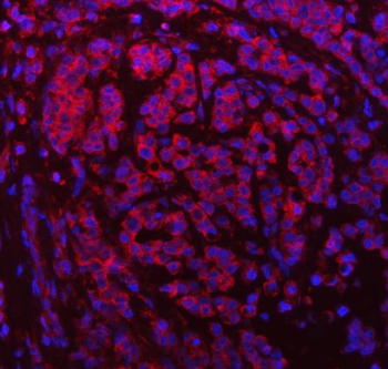 Anti-SDF2L1 Antibody