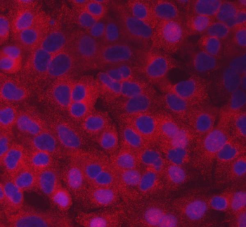 Anti-SCYL2 Antibody