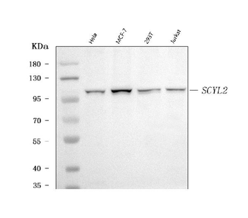 Anti-SCYL2 Antibody