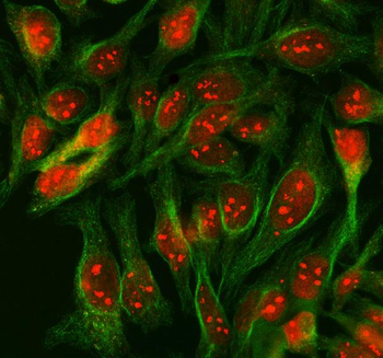 Anti-SCML1 Antibody