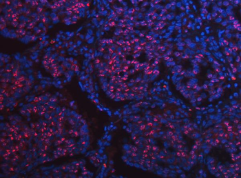 Anti-SCML1 Antibody