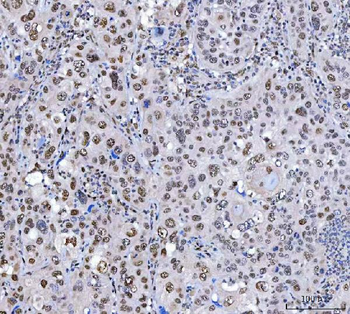 Anti-SCML1 Antibody