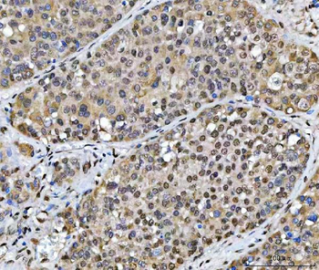 Anti-SCML1 Antibody