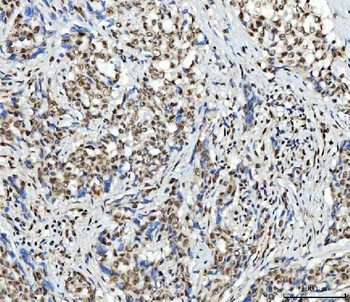 Anti-SCML1 Antibody