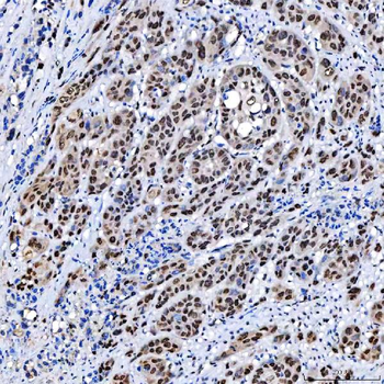 Anti-SCML1 Antibody