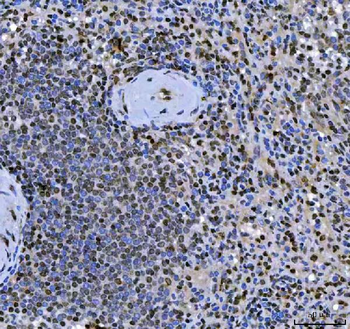 Anti-SCML1 Antibody