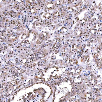 Anti-SCML1 Antibody