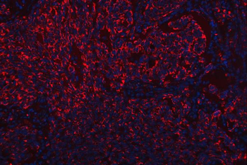 Anti-Scavenging Receptor SRB2/SCARB2 Antibody