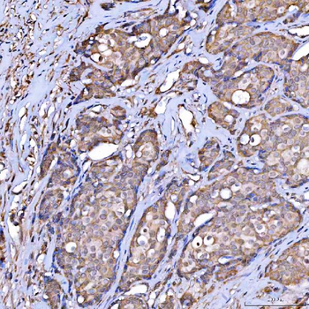 Anti-Scavenging Receptor SRB2/SCARB2 Antibody