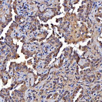 Anti-Scavenging Receptor SRB2/SCARB2 Antibody