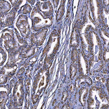 Anti-Scavenging Receptor SRB2/SCARB2 Antibody