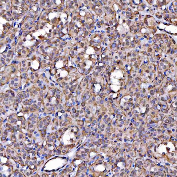 Anti-Scavenging Receptor SRB2/SCARB2 Antibody