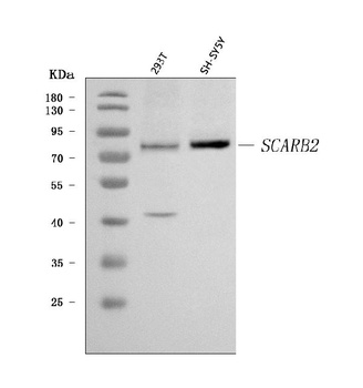 Scavenging Receptor SRB2/SCARB2 Antibody
