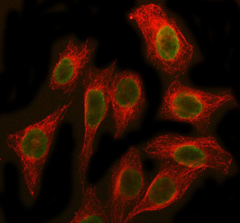 Anti-SBDS Antibody