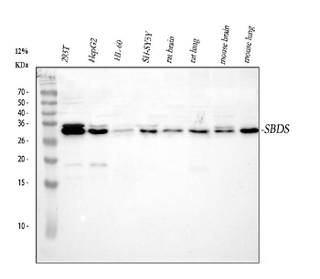 Anti-SBDS Antibody