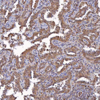 Anti-SAV1 Antibody
