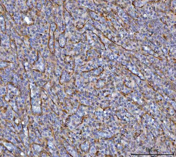 Anti-SAV1 Antibody