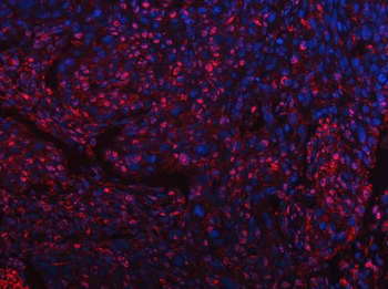 Anti-SART3 Antibody