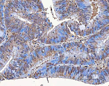 Anti-SART3 Antibody